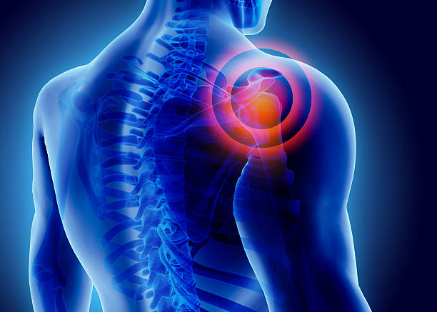 Shoulder Pain